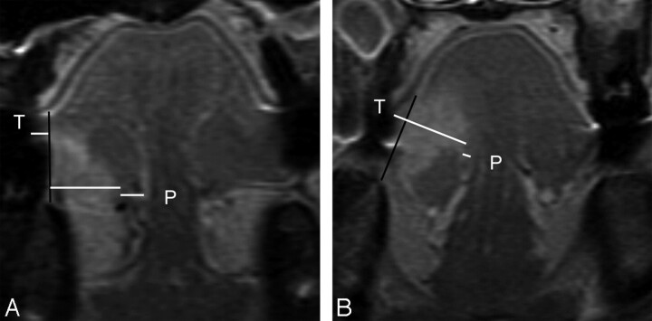 Fig 2.