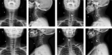 Fig. 9