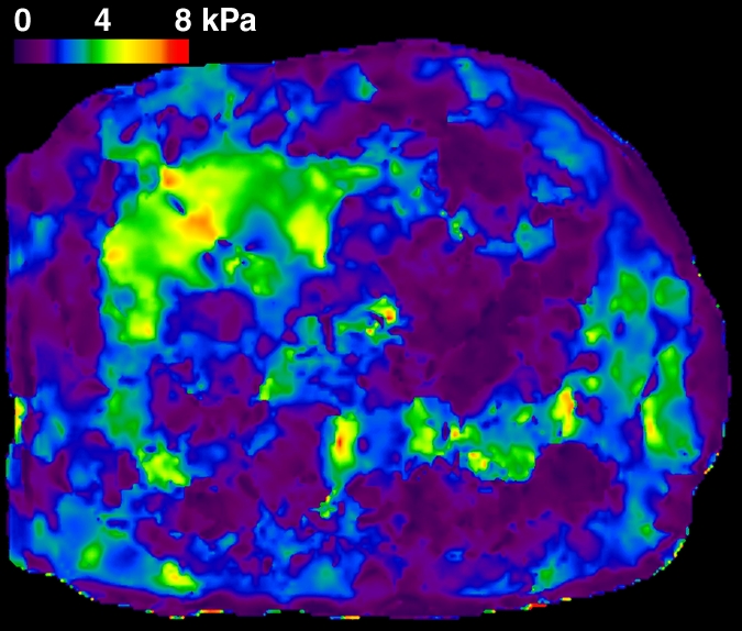 Figure 1e: