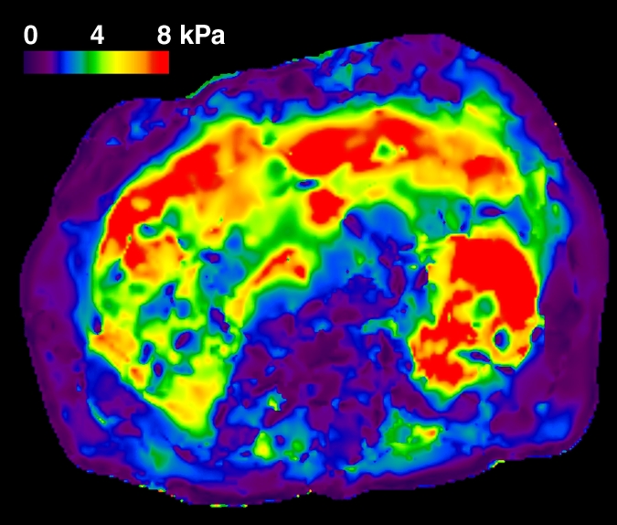 Figure 1f: