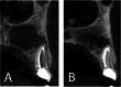 Fig. 9