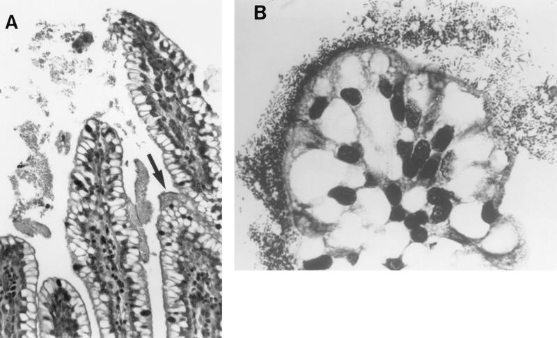 FIG. 10