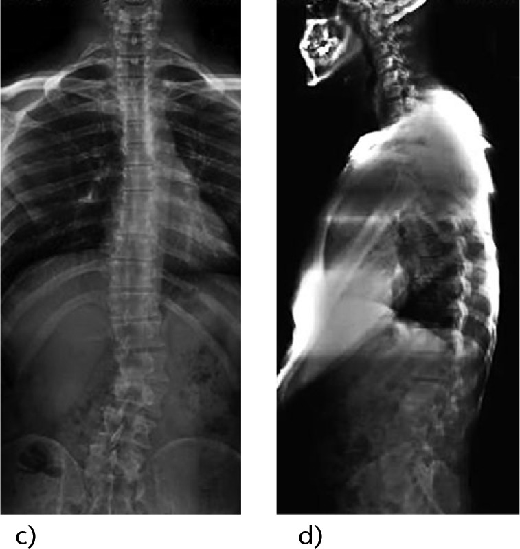 Fig. 1c and d