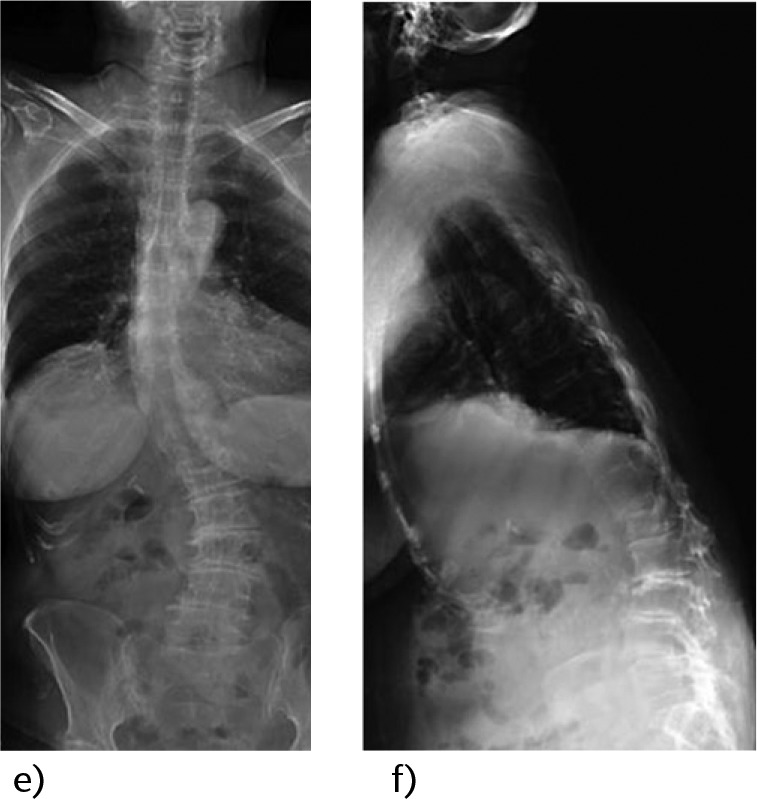 Fig 1e and f