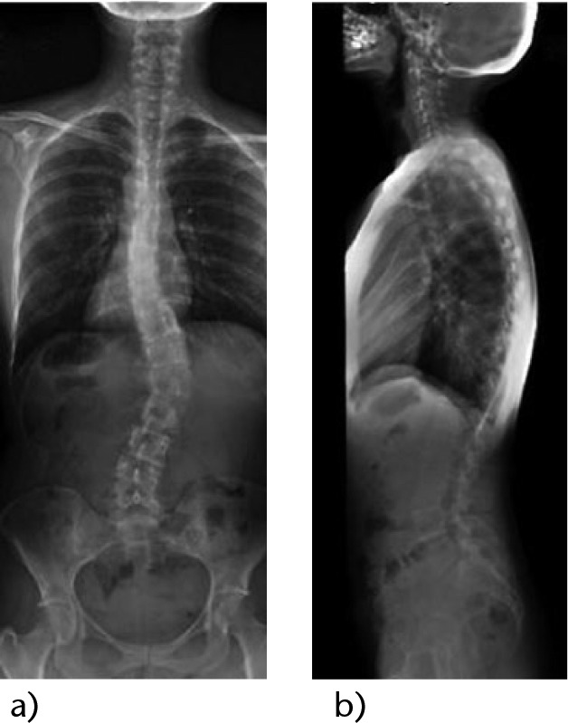 Fig. 1a and b