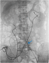 Fig. 3