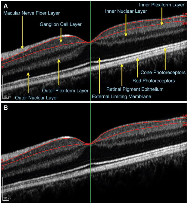 FIG. 1