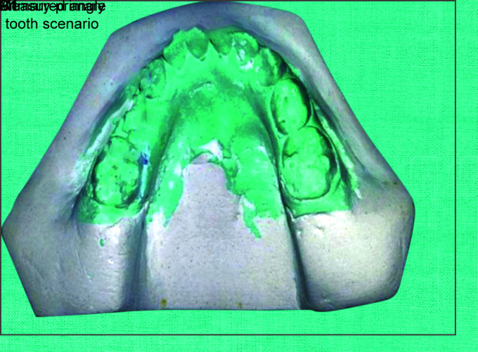 Fig. 2: