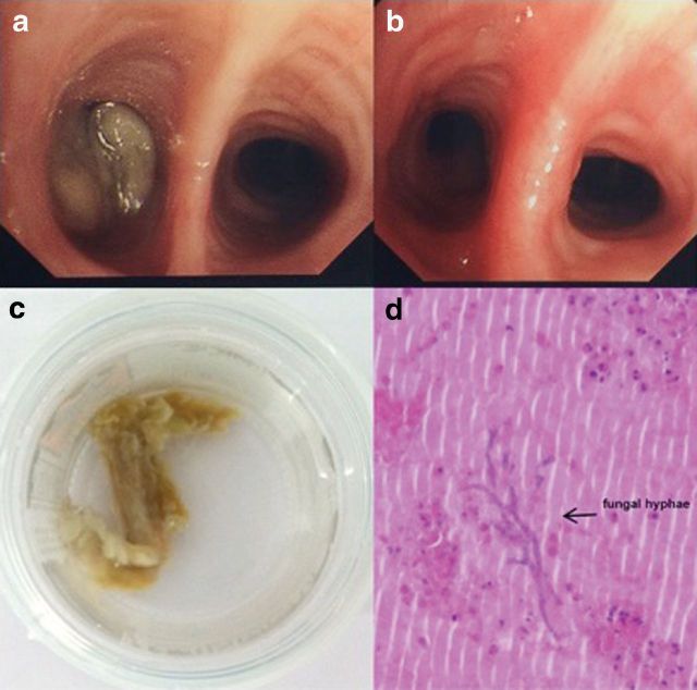 Fig 3.