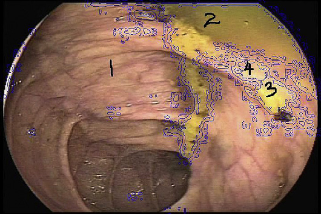 Fig. 6