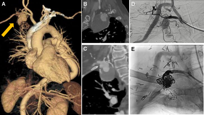 Fig 3