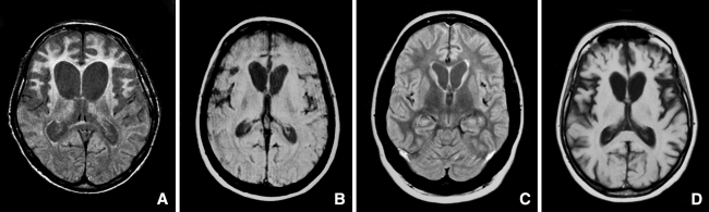 Fig. 1