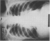 604