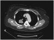 Figure-2.
