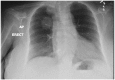 Figure-1.