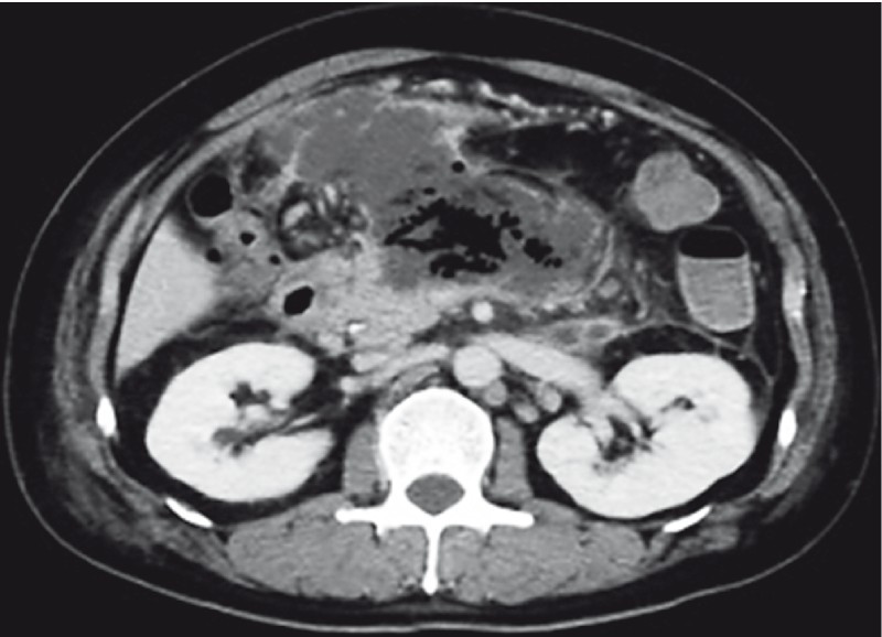 Fig. 1