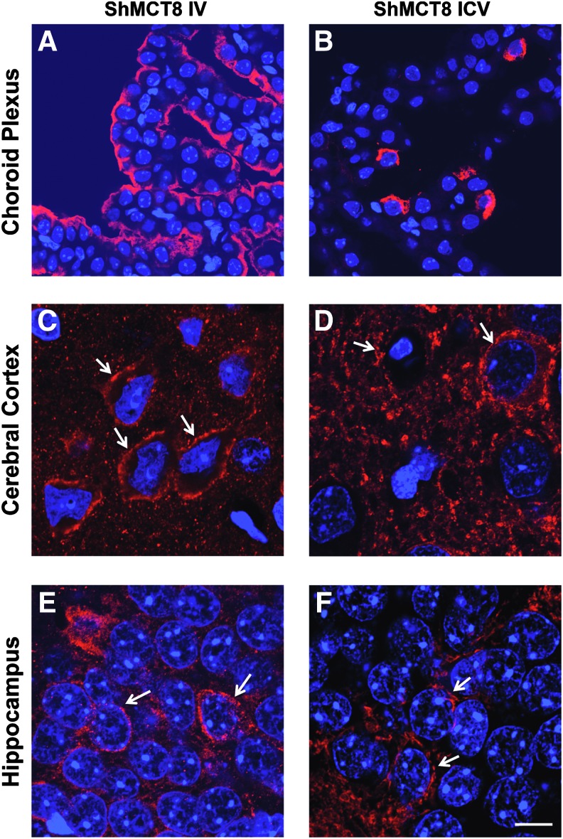 FIG. 4.