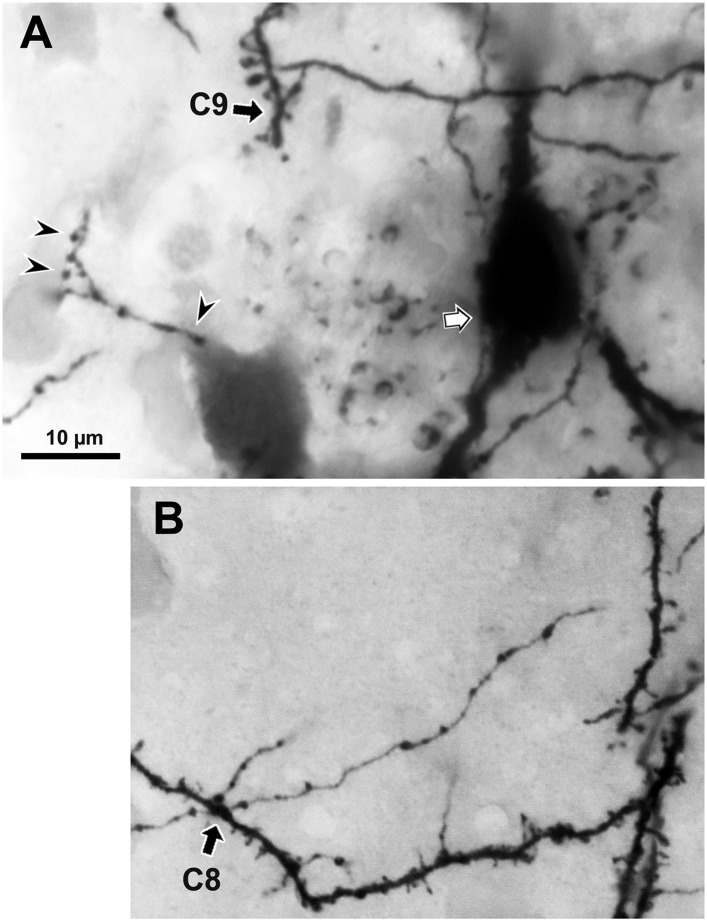 Figure 5—figure supplement 3.