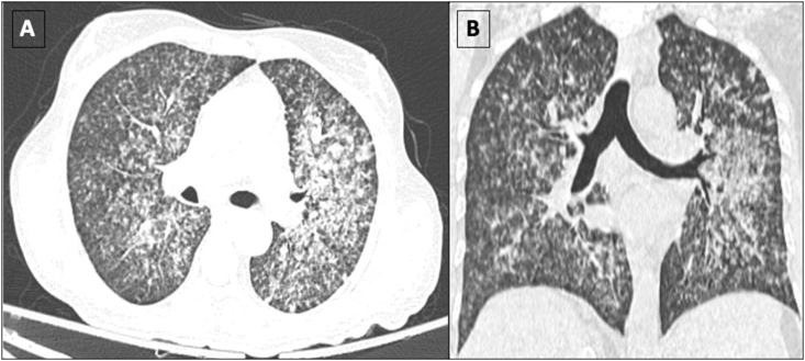 Figure 1