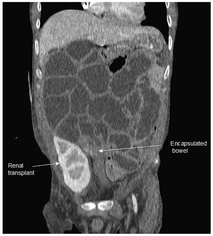 Figure 1 —