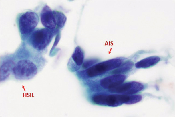 Figure 22: