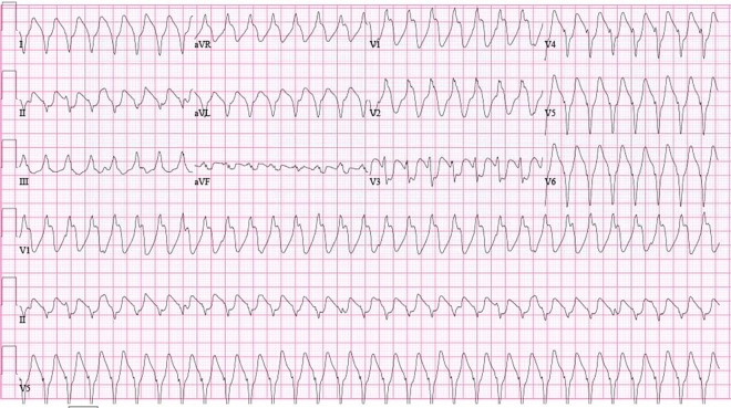 Figure 1