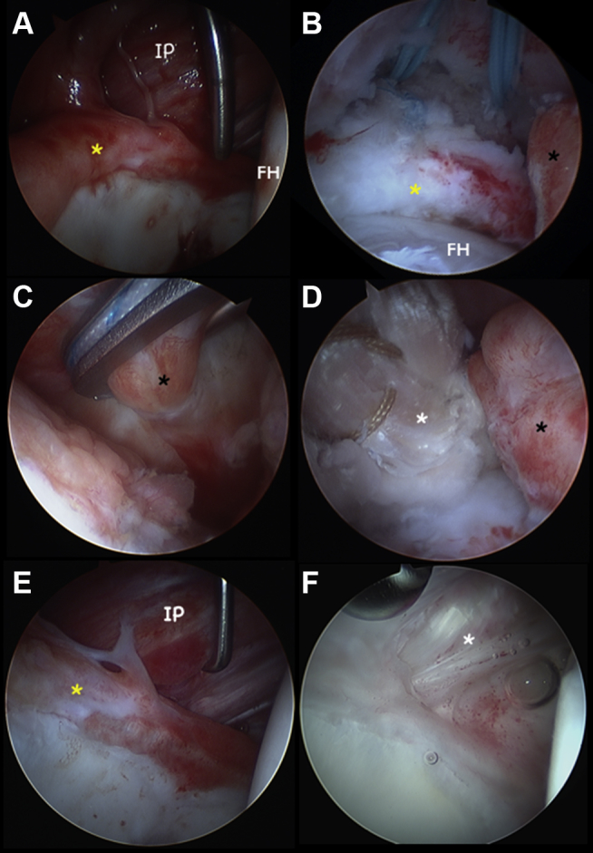 Fig 3