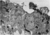 1882