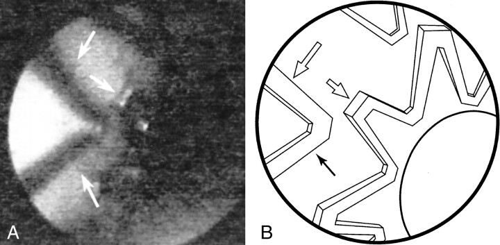 fig 3.