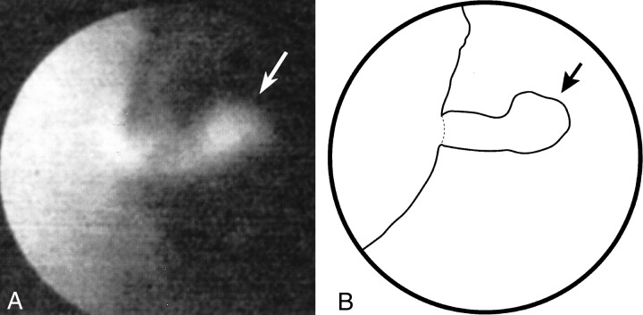 fig 5.