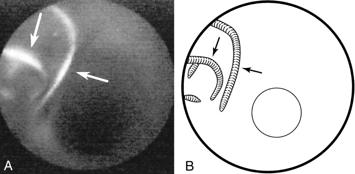 fig 4.