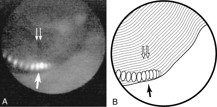 fig 2.