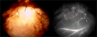 Fig. 12