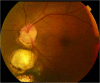 Fig. 9