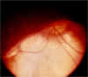 Fig. 10