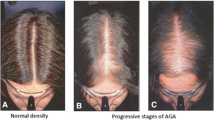 Fig. 3