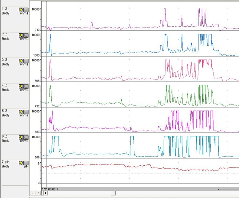 Figure 2