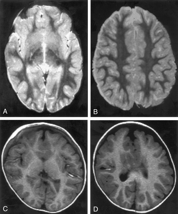 Fig 2.