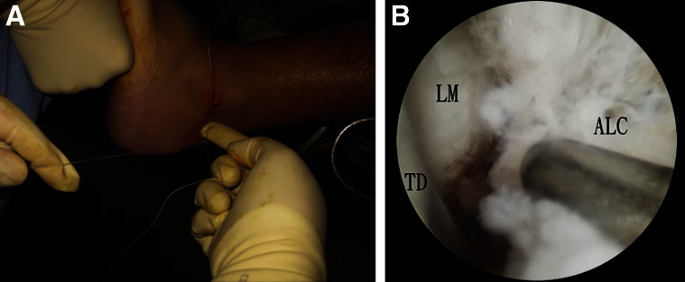 Fig 6