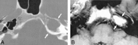 <sc>fig</sc> 2.