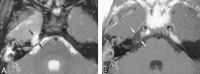 <sc>fig</sc> 4.