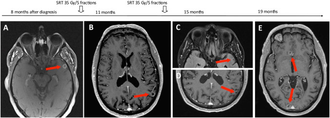 Fig. 4