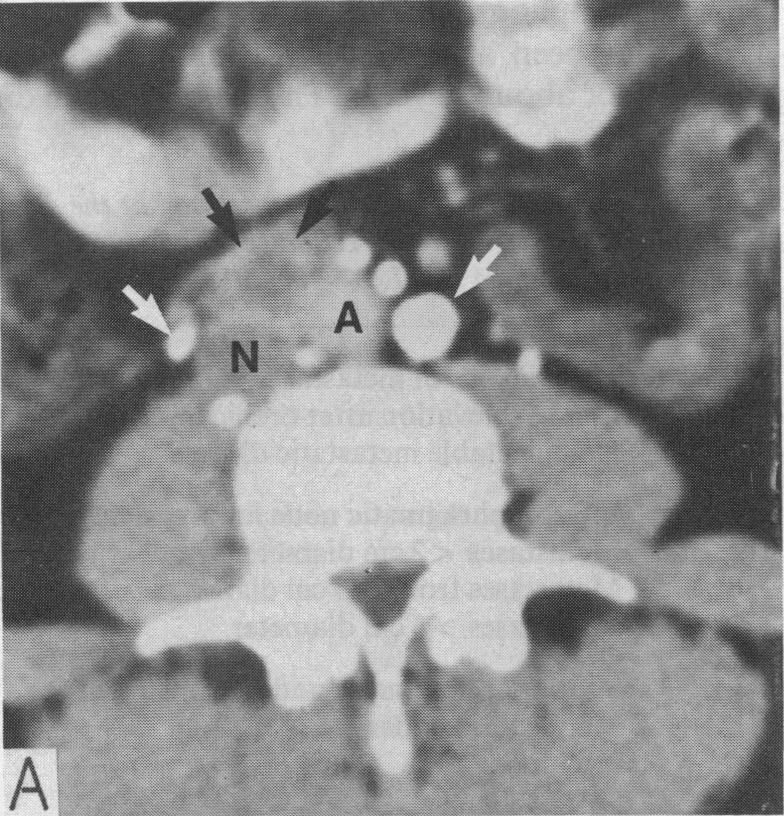 Figure 1 A