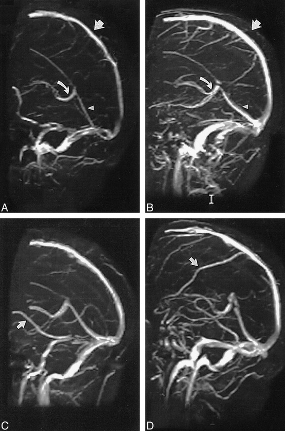 fig 3.