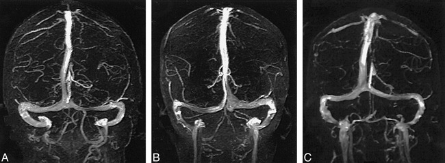 fig 1.