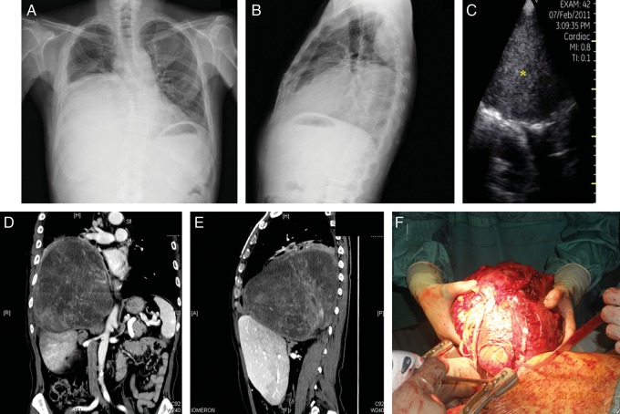 Figure 4: