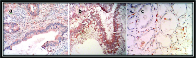 [Table/Fig-6]: