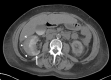 Fig 4 –