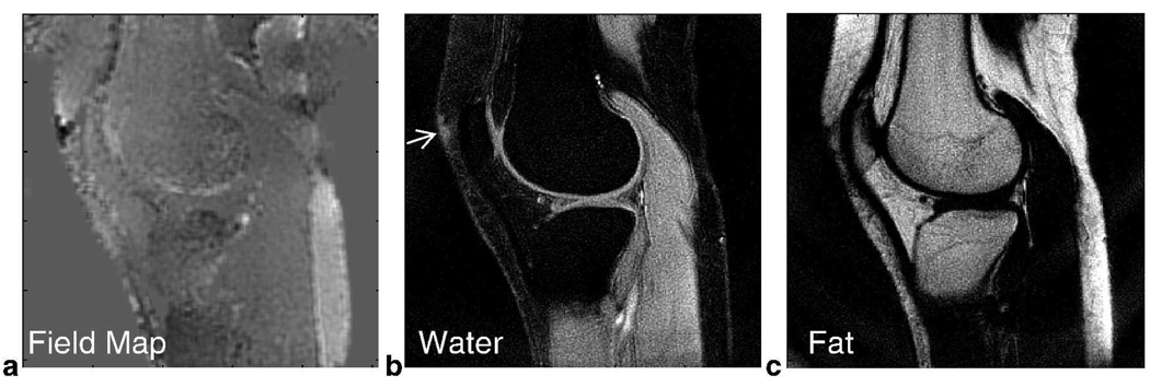 FIG. 6