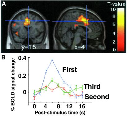 Fig 4.